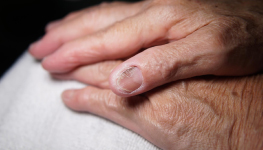 2021 Study of Nail Fungus