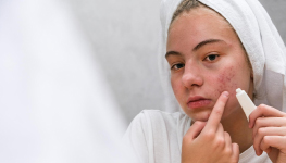 2022 Studies of the Market for Acne Products – Young Adults & Teens