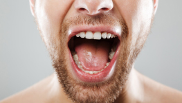 2022 Study of Dry Mouth